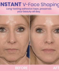 LAOZIK V-shaped face Lifting Invisible Adhesive Tape