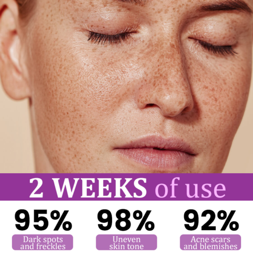 LAOZIK™ MelantraX Advanced Anti-Hyperpigmentation Essence - Image 2