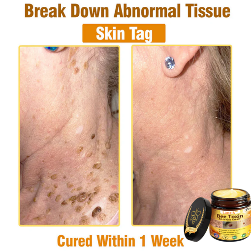 LAOZIK™ Bee Toxin All-in-One Cream - Image 3