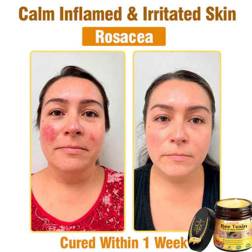LAOZIK™ Bee Toxin All-in-One Cream - Image 5