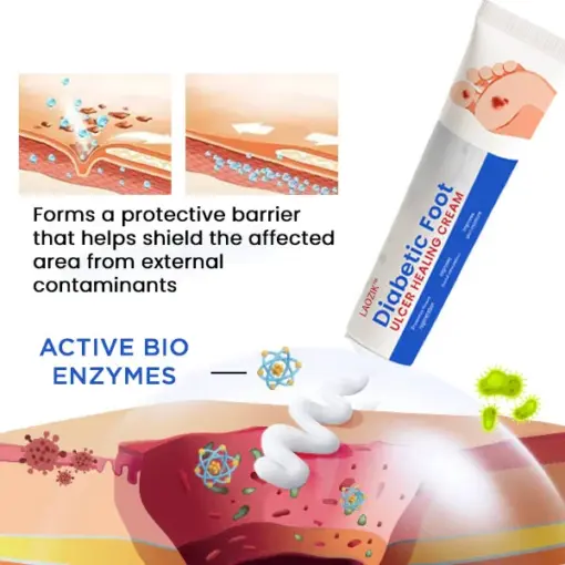 LAOZIK™ Diabetic Foot Ulcer Healing Cream - Image 4