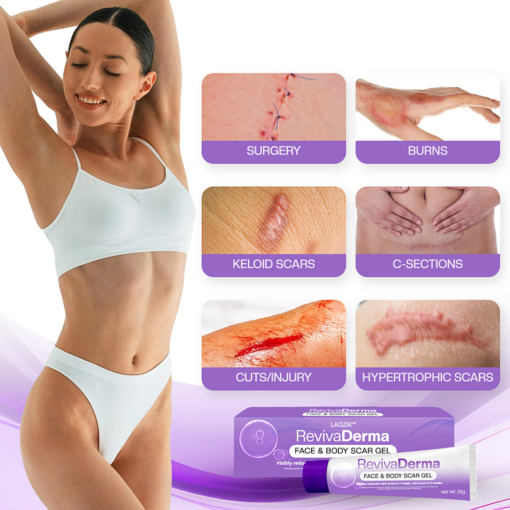 LAOZIK™ RevivaDerma Face & Body Scar Gel - Image 4