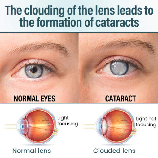LAOZIK™ OptiFusion Nano Eye Drops Serum - Image 4