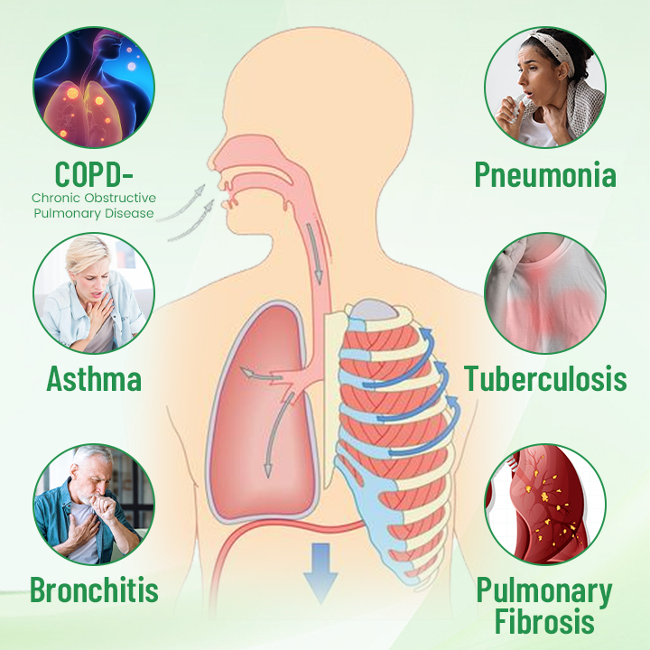 LAOZIK™ SinuEase Herbal Lung Detox Inhaler - Image 2