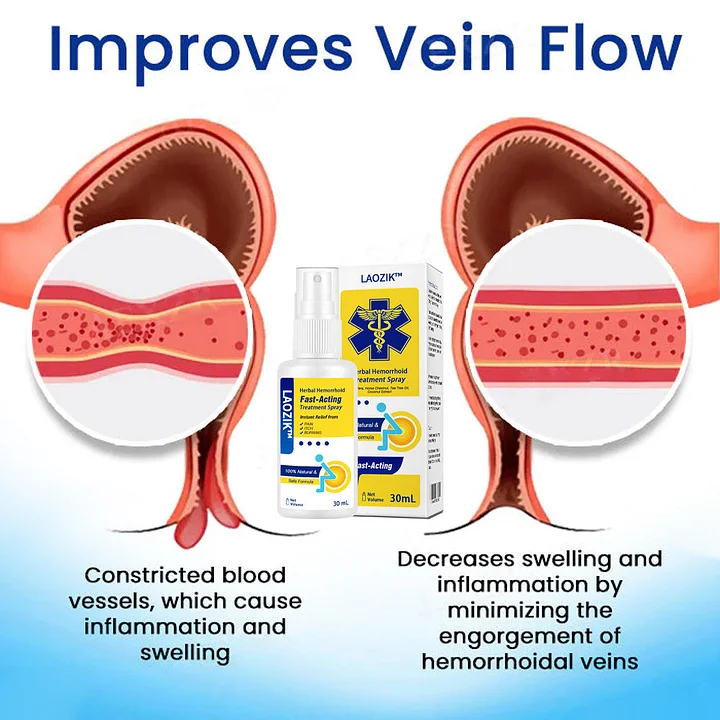 LAOZIK™ Herbal Hemorrhoids Fast-Acting Treatment Spray - Image 3