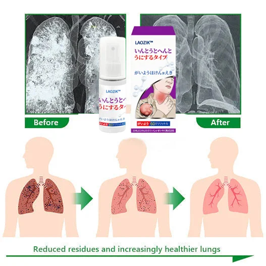 LAOZIK™ Advanced Throat & Lung Spray
