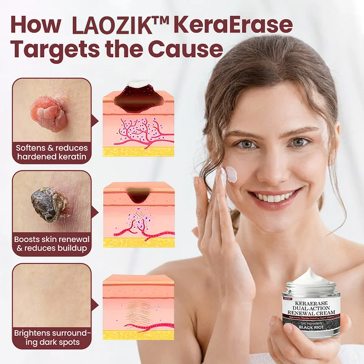 Laozik®KeraErase Dual-Action Renewal Cream - Image 4