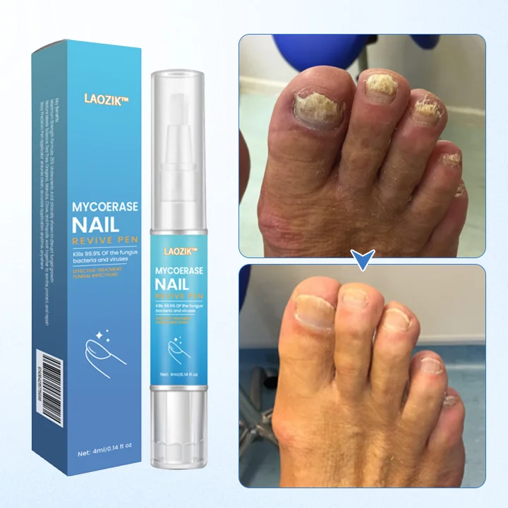 LAOZIK™ MycoErase Nail Revive Pen - Image 3