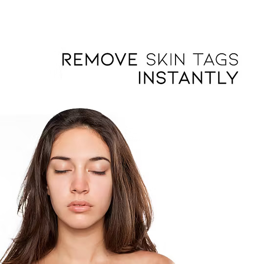 LAOZIK™ WipeOff Tags & Mole Remover - Image 3